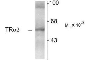 Western Blotting (WB) image for anti-Thyroid Hormone Receptor, alpha (THRA) (N-Term) antibody (ABIN371845)
