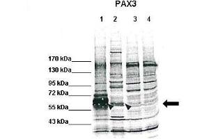 WB Suggested Anti-PAX3 Antibody    Positive Control:  Lane 1: Flag-PAX3(overexpression, human), HEK293, 50? (Paired Box 3 antibody  (C-Term))