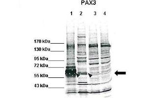 WB Suggested Anti-PAX3 Antibody    Positive Control:  Lane 1: Flag-PAX3(overexpression, human), HEK293, 50?