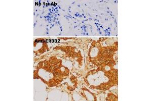 Immunohistochemistry (IHC) image for anti-Receptor tyrosine-protein kinase erbB-2 (ErbB2/Her2) (C-Term) antibody (ABIN6254225) (ErbB2/Her2 antibody  (C-Term))
