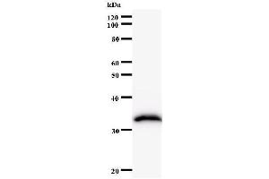 Western Blotting (WB) image for anti-FtsJ RNA Methyltransferase Homolog 2 (FTSJ2) antibody (ABIN931161) (FTSJ2 antibody)