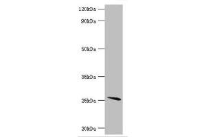 Western blot All lanes: Glutathione S-transferase A2 antibody at 4 μg/mL + Mouse liver tissue Secondary Goat polyclonal to rabbit IgG at 1/10000 dilution Predicted band size: 26 kDa Observed band size: 26 kDa (GSTa2 antibody  (AA 1-222))