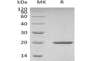 Western Blotting (WB) image for Sonic Hedgehog (SHH) (Active) protein (ABIN7320696) (Sonic Hedgehog Protein (SHH))