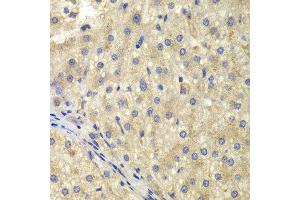 Immunohistochemistry of paraffin-embedded human liver injury using NEK8 antibody at dilution of 1:200 (400x lens). (NEK8 antibody)