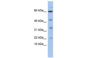 WB Suggested Anti-LMO2 Antibody Titration:  0. (LMO2 antibody  (N-Term))