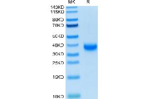 Biotinylated SARS-COV-2 Spike RBD on Tris-Bis PAGE under reduced condition. (SARS-CoV-2 Spike Protein (RBD) (His-Avi Tag,Biotin))