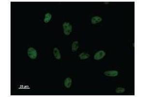 Immunostaining analysis in HeLa cells. (BCL3 antibody)