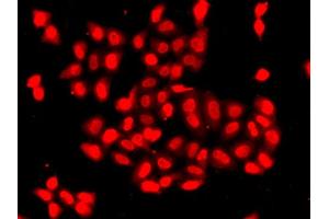 Immunofluorescence analysis of A549 cell using CAMK1D antibody. (CAMK1D antibody)
