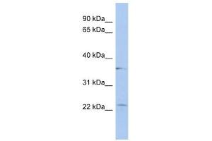 LYSMD2 antibody used at 1 ug/ml to detect target protein. (LYSMD2 antibody  (Middle Region))