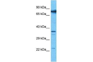 Host:  Rabbit  Target Name:  COMP  Sample Type:  786-0 Whole Cell lysates  Antibody Dilution:  1. (COMP antibody  (N-Term))