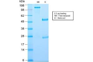 SDS-PAGE Analysis of Purified Thymidine Phosphorylase Rabbit Recombinant Monoclonal (TYMP/2890R). (Recombinant Thymidine Phosphorylase antibody)