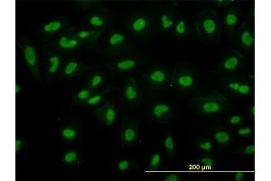 Immunofluorescence (IF) image for anti-Retinoblastoma Binding Protein 4 (RBBP4) (AA 1-425) antibody (ABIN562598)
