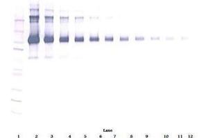 Image no. 2 for anti-CD22 Molecule (CD22) antibody (ABIN465261) (CD22 antibody)