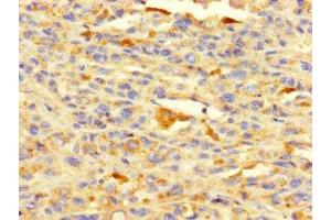 Immunohistochemistry (IHC) image for anti-Histone Deacetylase 1 (HDAC1) (AA 1-482) antibody (ABIN7155301)