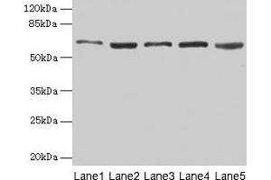 Western blot All lanes: STIP1 antibody at 12 μg/mL Lane 1: Hela whole cell lysate Lane 2: HepG2 whole cell lysate Lane 3: NIH/3T3 whole cell lysate Lane 4: Jurkat whole cell lysate Lane 5: Rat gonadal tissue Secondary Goat polyclonal to rabbit IgG at 1/10000 dilution Predicted band size: 63, 69, 60 kDa Observed band size: 63 kDa (STIP1 antibody  (AA 1-543))