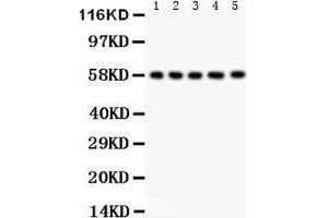 Anti- AGFG1 antibody, Western blotting All lanes: Anti AGFG1  at 0. (AGFG1 antibody  (N-Term))