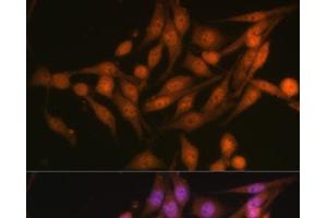 Immunofluorescence analysis of HeLa cells using PSMD13 Polyclonal Antibody at dilution of 1:100 (40x lens).