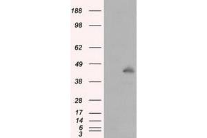 Western Blotting (WB) image for anti-Induced Myeloid Leukemia Cell Differentiation Protein Mcl-1 (MCL1) antibody (ABIN1499344) (MCL-1 antibody)