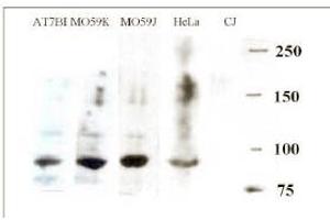 Western blotting with anti-ARTEMIS antibody ABIN117935 at a 1:500 dilution in various cell lysates.