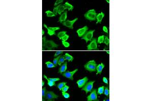 Immunofluorescence analysis of  cells using HSP27/HSP27/HSPB1 antibody (ABIN6128036, ABIN6142051, ABIN6142053 and ABIN6217766). (HSP27 antibody  (AA 1-100))