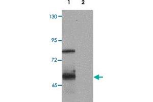Western blot analysis of ORMDL1 in SK-N-SH Cell lysate with ORMDL1 polyclonal antibody  at 1 ug/mL (lane 1) and 2 ug/mL (lane 2).