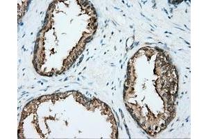 Immunohistochemical staining of paraffin-embedded liver tissue using anti-DNTTIP1 mouse monoclonal antibody. (DNTTIP1 antibody)