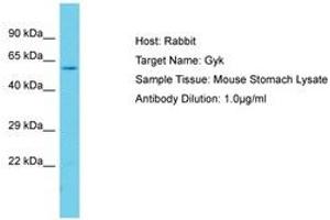 Image no. 1 for anti-Glycerol Kinase (GK) (AA 101-150) antibody (ABIN6750351) (Glycerol Kinase antibody  (AA 101-150))