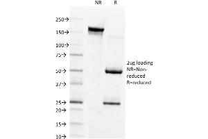 SDS-PAGE Analysis Purified Connexin 32 Mouse Monoclonal Antibody (Clone M12. (GJB1 antibody)