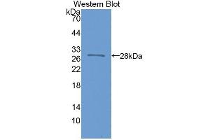 Detection of Recombinant NOS1AP, Human using Polyclonal Antibody to Nitric Oxide Synthase 1 Adaptor Protein (NOS1AP) (NOS1AP antibody  (AA 285-506))