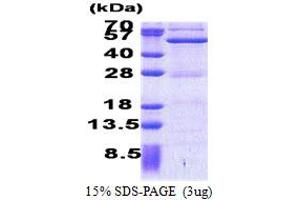 Activating Signal Cointegrator 1 Complex Subunit 1 (ASCC1) (AA 1-357) protein (His tag)
