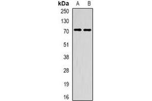 Western blot analysis of METTL3 expression in HepG2 (A), mouse spleen (B) whole cell lysates. (METTL3 antibody)