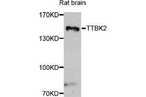 Western blot analysis of extracts of rat brain, using TTBK2 antibody. (TTBK2 antibody)