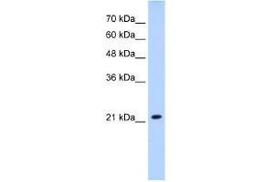 SLC25A14 antibody used at 2. (SLC25A14 antibody)