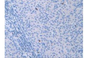 Figure. (ATF6 antibody  (AA 1-377))