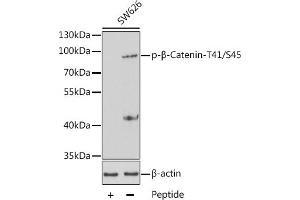 Western blot analysis of extracts from SW626 cells using Phospho-β-Catenin-T41/S45 antibody (ABIN3020171, ABIN3020172 and ABIN3020173). (CTNNB1 antibody  (pSer45, pThr41))