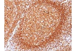 IHC testing of FFPE human tonsil stained with CD79a antibody (clone JCB117). (CD79a antibody  (AA 202-216))