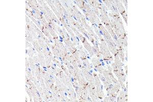 Immunohistochemistry of paraffin-embedded mouse heart using N-Cadherin Rabbit mAb (ABIN7265999) at dilution of 1:100 (40x lens). (N-Cadherin antibody)