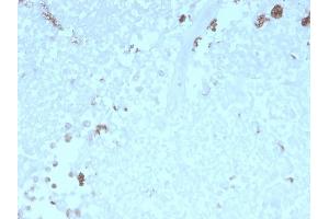 Formalin-fixed, paraffin-embedded human Uterus stained with ATG5 Mouse Monoclonal Antibody (rATG5/2553). (Recombinant ATG5 antibody  (AA 1-119))