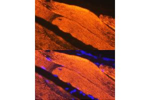 Immunofluorescence analysis of Mouse skeletal muscle using Calsequestrin 1 antibody (ABIN7266045) at dilution of 1:100. (Calsequestrin antibody)