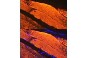 Immunofluorescence analysis of Mouse skeletal muscle using Calsequestrin 1 antibody (ABIN7266045) at dilution of 1:100.