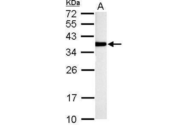 TST antibody