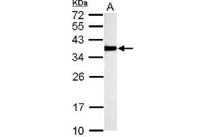 WB Image TST antibody detects TST protein by Western blot analysis.