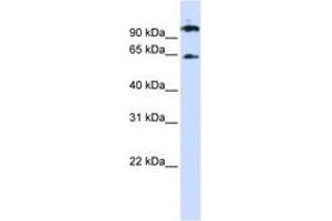 Image no. 1 for anti-Runt-Related Transcription Factor 1, Translocated To, 1 (Cyclin D-Related) (RUNX1T1) (AA 288-337) antibody (ABIN6744247) (RUNX1T1 antibody  (AA 288-337))
