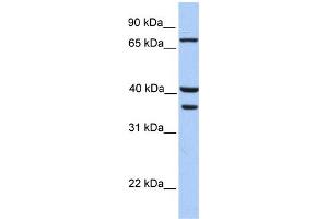 WB Suggested Anti-TGM5 Antibody Titration:  0. (Transglutaminase 5 antibody  (C-Term))
