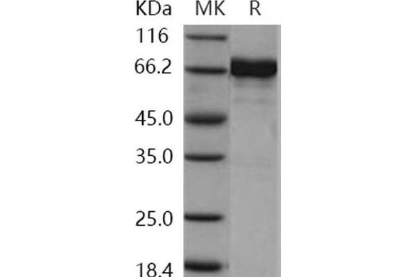 EPH Receptor A7 Protein (EPHA7) (GST tag,His tag)