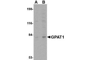 Western blot analysis of GPAT1 in rat brain tissue lysate with AP30375PU-N GPAT1 antibody at (A) 1 and (B) 2 μg/ml.