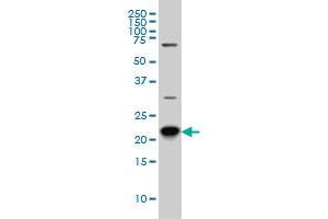 RAB8A monoclonal antibody (M02), clone 3G1 Western Blot analysis of RAB8A expression in Hela S3 NE .