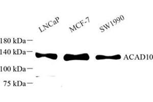 Western blot analysis of ACAD10 (ABIN7072924) at dilution of 1: 500 (ACAD10 antibody)