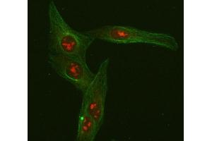 IF analysis of FOXO3A using anti-FOXO3A antibody (ABIN3042404) and anti-Beta Tubulin antibody (ABIN7602743). (FOXO3 antibody  (AA 471-673))