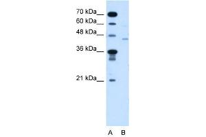 FKTN antibody used at 5 ug/ml to detect target protein. (Fukutin antibody  (N-Term))